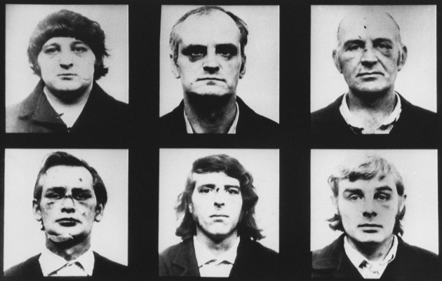 Birmingham Six Photos Bruises